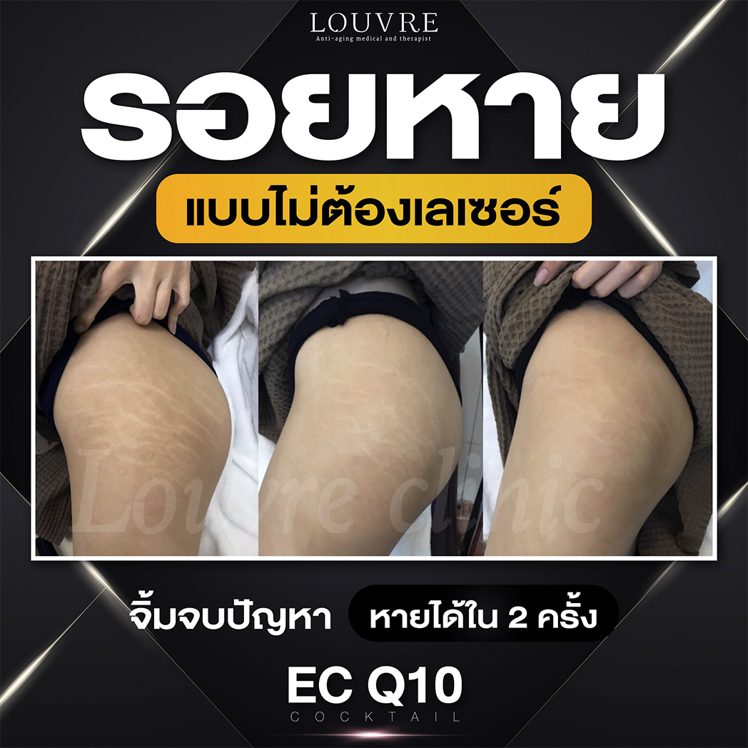 รีวิว-6